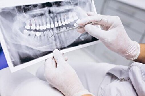 دردناک ولی واقعی: کشیدن دندان به خاطر نداشتن هزینه درمان